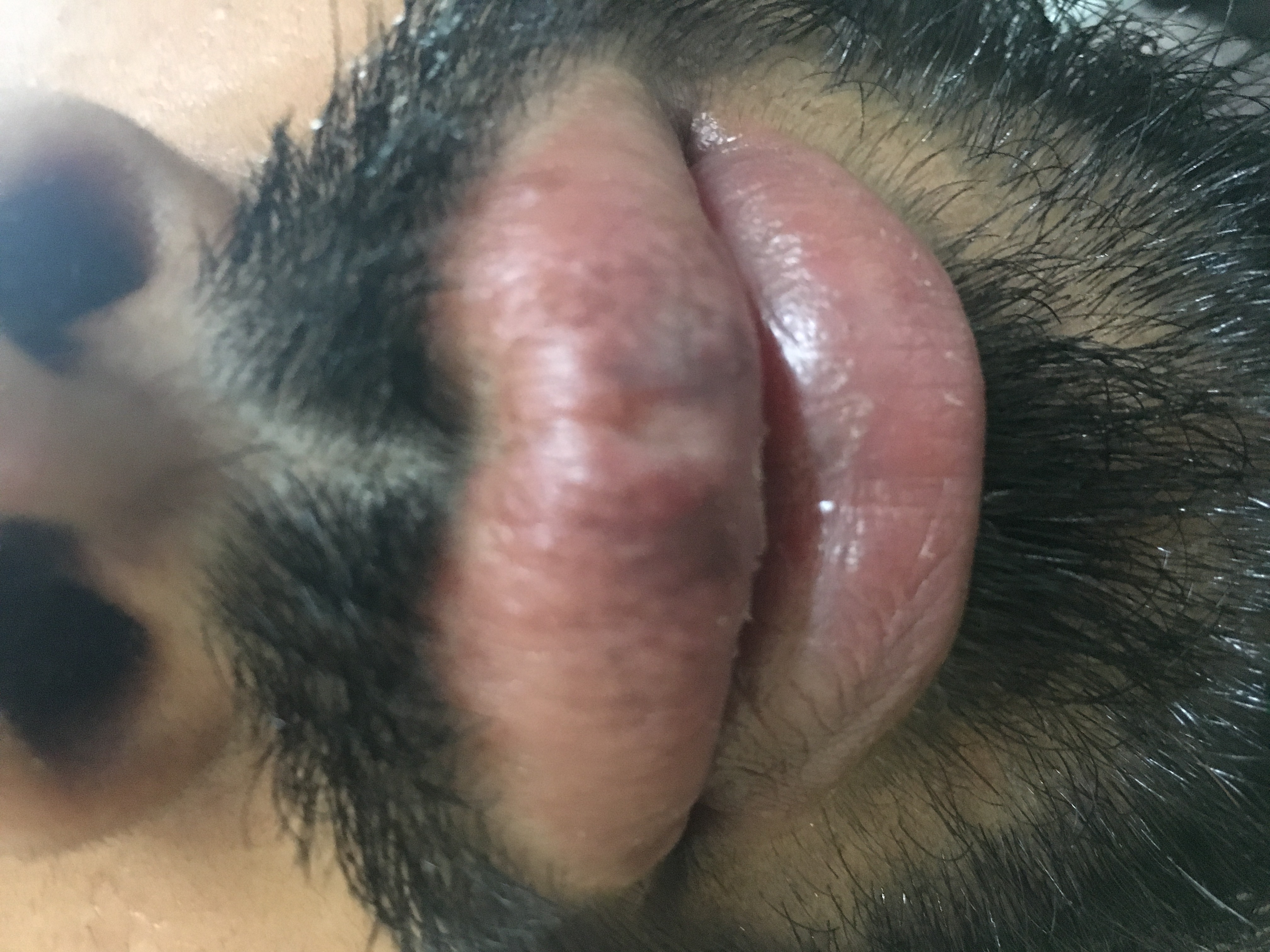 Identify The Condition